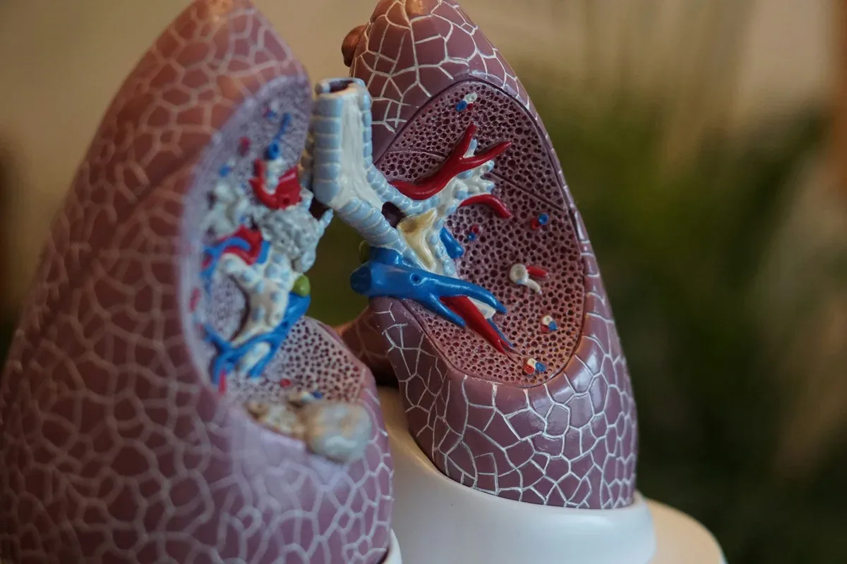 Microplásticos aparecem em 70% das amostras pulmonares analisadas