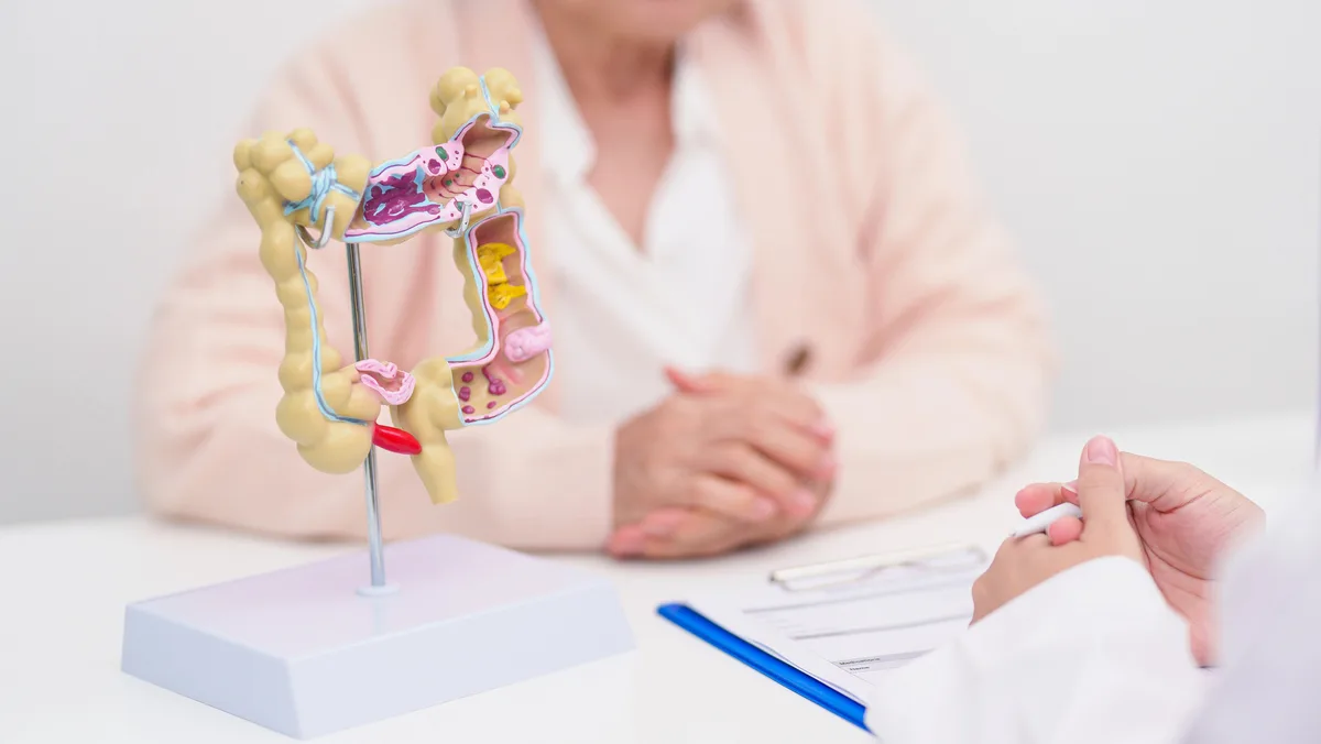 Teste fecal amplia triagem para câncer de cólon e reto pelo SUS