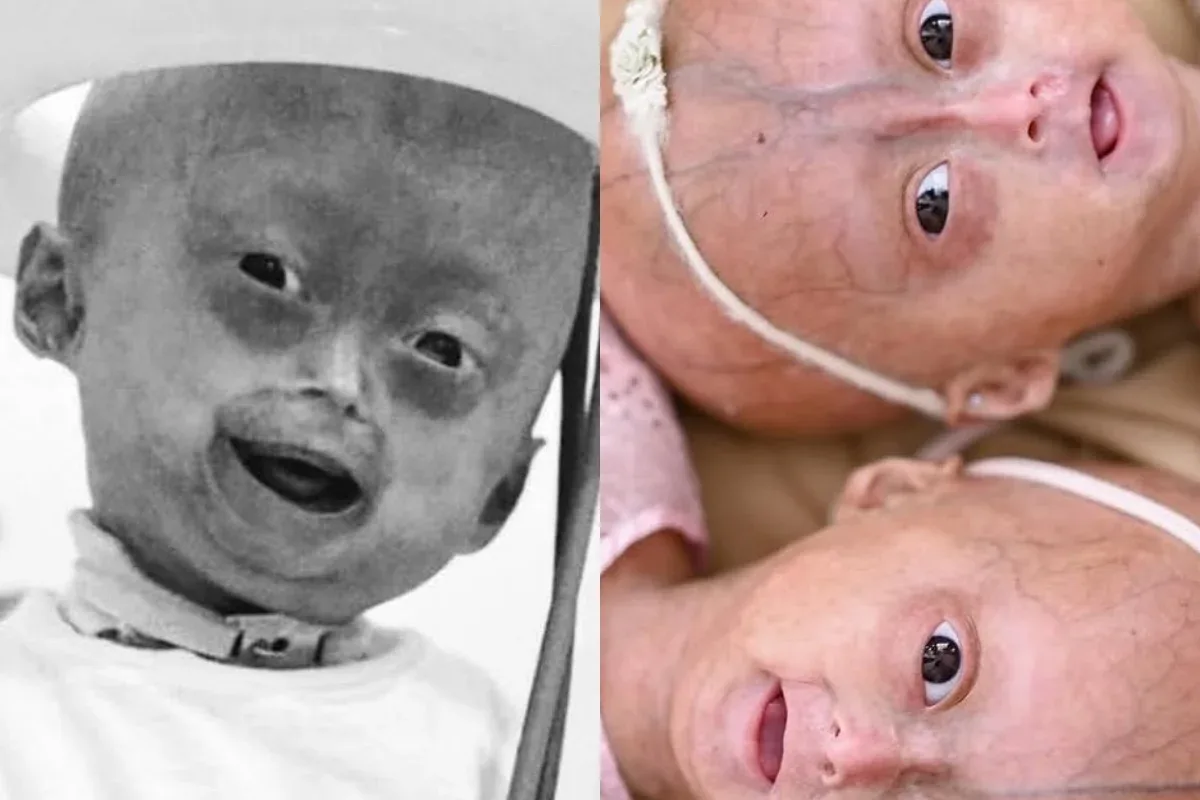 Perfil de Elis e Eloá reunia mais de 1,3 milhão de seguidores