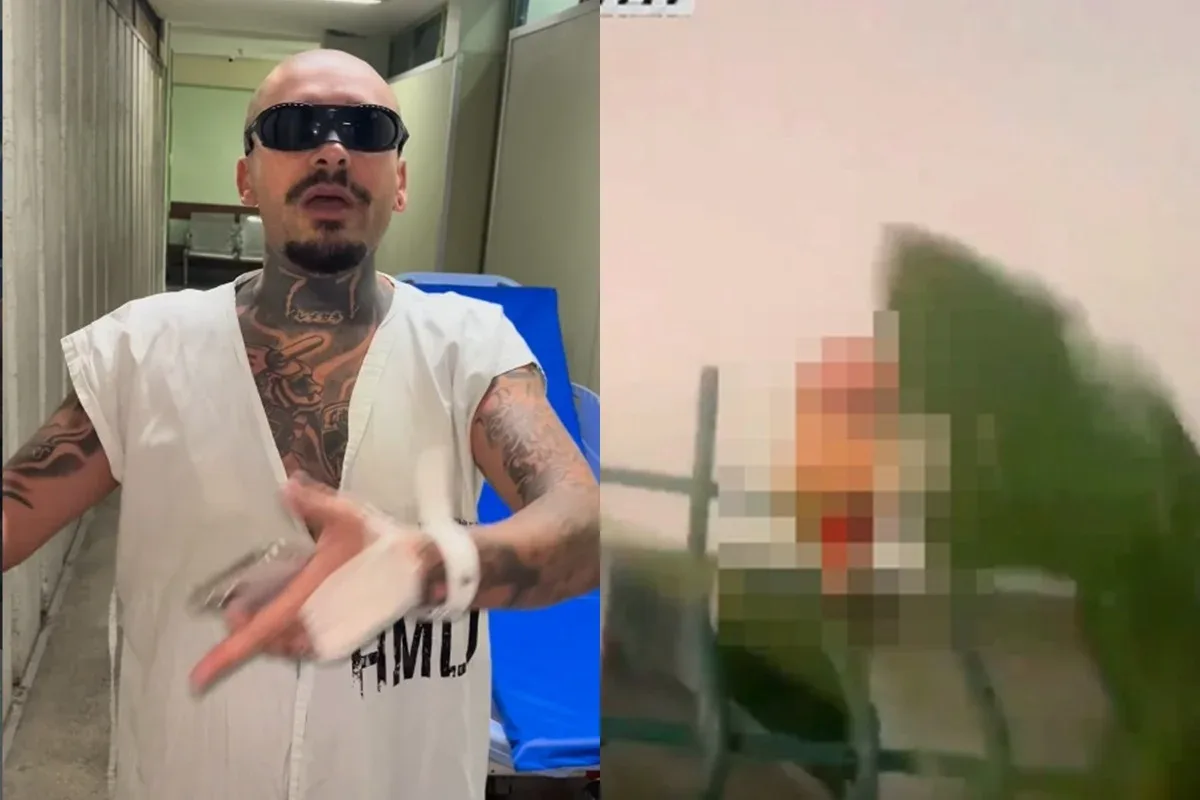 LODK diz que vai leiloar dedo após acidente em tentativa de entrada no Rock in Rio
